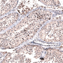 GLI-1 Antibody (CL12192), Novus Biologicals 100 &mu;g; Unconjugated:Antibodies,