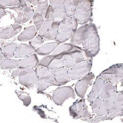 Chitinase 3-like 1 Antibody (CL12241), Novus Biologicals:Antibodies:Primary