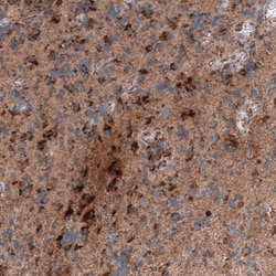 Chitinase 3-like 1 Antibody (CL12241), Novus Biologicals:Antibodies:Primary