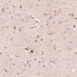 Chitinase 3-like 1 Antibody (CL12241), Novus Biologicals:Antibodies:Primary