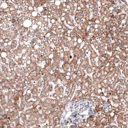 Chitinase 3-like 1 Antibody (CL12241), Novus Biologicals:Antibodies:Primary