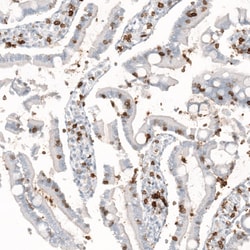 CD5 Antibody (CL12420), Novus Biologicals 25 &mu;g; Unconjugated:Antibodies,