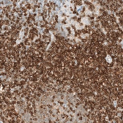 CD5 Antibody (CL12420), Novus Biologicals 25 &mu;g; Unconjugated:Antibodies,