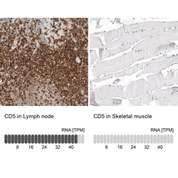 CD5 Antibody (CL12420), Novus Biologicals 25 &mu;g; Unconjugated:Antibodies,