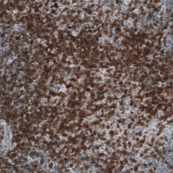 CD5 Antibody (CL12420), Novus Biologicals 25 &mu;g; Unconjugated:Antibodies,