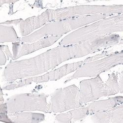 CD5 Antibody (CL12420), Novus Biologicals 25 &mu;g; Unconjugated:Antibodies,