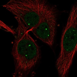 HIF-1 alpha Antibody, Novus Biologicals 100 &mu;g; Unconjugated:Antibodies,