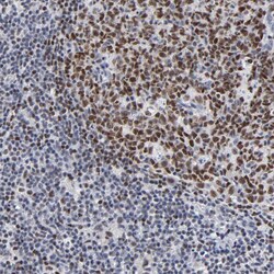 MBD4 Antibody, Novus Biologicals:Antibodies:Primary Antibodies