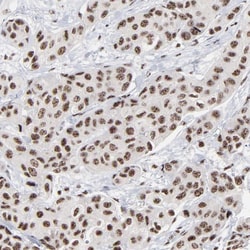 MBD4 Antibody, Novus Biologicals:Antibodies:Primary Antibodies