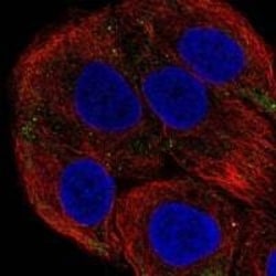Laminin beta 3 Antibody, Novus Biologicals 25 &mu;L; Unconjugated:Antibodies,