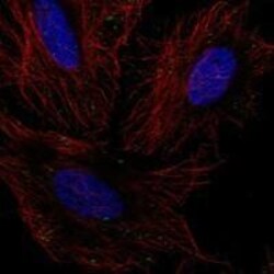 GLT8D2 Antibody, Novus Biologicals 100 &mu;L; Unconjugated:Antibodies,