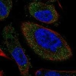 Tyrosine Hydroxylase Antibody, Novus Biologicals 100 &mu;L; Unconjugated:Antibodies,