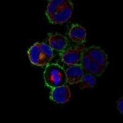 CD30/TNFRSF8 Antibody, Novus Biologicals:Antibodies:Primary Antibodies