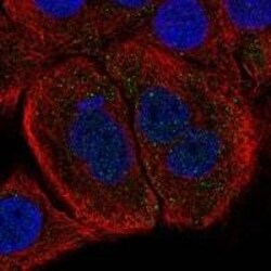 Follistatin Antibody, Novus Biologicals 25 &mu;L | Buy Online | Novus Biologicals | Fisher Scientific