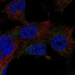 Hexosaminidase A/HEXA Antibody, Novus Biologicals 100 &mu;g; Unconjugated:Antibodies,