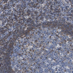 IL-16 Antibody, Novus Biologicals 100 &mu;g; Unconjugated:Antibodies, Polyclonal
