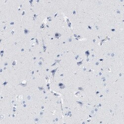 IL-16 Antibody, Novus Biologicals 100 &mu;g; Unconjugated:Antibodies, Polyclonal