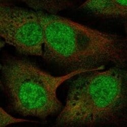 UFD1L Antibody, Novus Biologicals 100 &mu;g; Unconjugated:Antibodies, Polyclonal