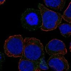 ICOS Antibody, Novus Biologicals 25 &mu;g; Unconjugated:Antibodies, Polyclonal