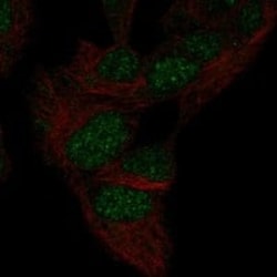 Mxi1 Antibody, Novus Biologicals:Antibodies:Primary Antibodies