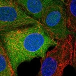 TRPM7 Antibody, Novus Biologicals 100 &mu;g; Unconjugated:Antibodies, Polyclonal
