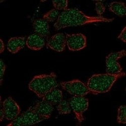 TdT Antibody, Novus Biologicals 100 &mu;g; Unconjugated:Antibodies, Polyclonal