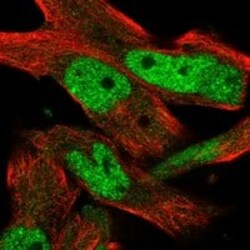 INTS13 Antibody, Novus Biologicals 100 &mu;g; Unconjugated:Antibodies,