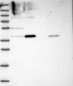 INTS13 Antibody, Novus Biologicals 100 &mu;g; Unconjugated:Antibodies,