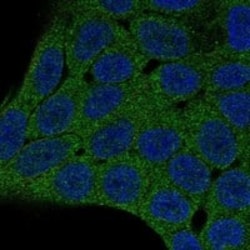 PHLPP2 Antibody, Novus Biologicals 25 &mu;g; Unconjugated:Antibodies, Polyclonal