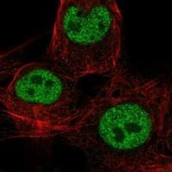 CDX4 Antibody, Novus Biologicals 100 &mu;g; Unconjugated:Antibodies, Polyclonal