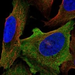 Nav1.6 Antibody, Novus Biologicals 25 &mu;g; Unconjugated:Antibodies, Polyclonal