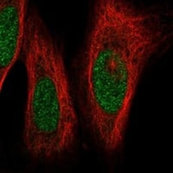 LIM1 Antibody, Novus Biologicals 25 &mu;g; Unconjugated:Antibodies, Polyclonal