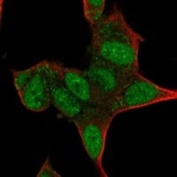 Islet-1 Antibody, Novus Biologicals 25 &mu;g; Unconjugated:Antibodies,