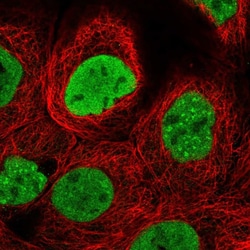 Histone H2AX Antibody, Novus Biologicals 100 &mu;g; Unconjugated:Antibodies,