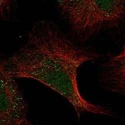 ADAMTS13 Antibody, Novus Biologicals 25 &mu;g; Unconjugated:Antibodies,