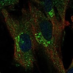 TREM1 Antibody, Novus Biologicals 25 &mu;g; Unconjugated:Antibodies, Polyclonal