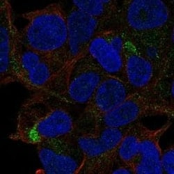 TSLP Antibody, Novus Biologicals:Antibodies:Primary Antibodies