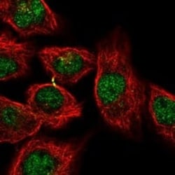 KCTD1 Antibody, Novus Biologicals:Antibodies:Primary Antibodies
