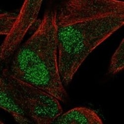 LIMD2 Antibody, Novus Biologicals:Antibodies:Primary Antibodies