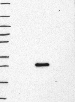 LMO2 Antibody, Novus Biologicals:Antibodies:Primary Antibodies