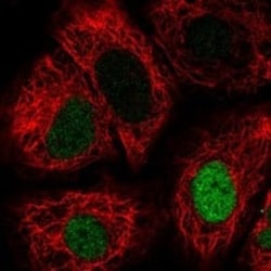 p53 Antibody, Novus Biologicals:Antibodies:Primary Antibodies