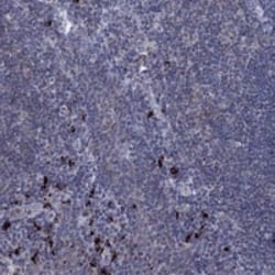 CD155/PVR Antibody, Novus Biologicals:Antibodies:Primary Antibodies