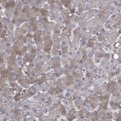 Hemopexin Antibody, Novus Biologicals 100 &mu;g | Buy Online | Novus Biologicals | Fisher Scientific