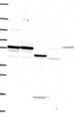 IL-10R alpha Antibody, Novus Biologicals 100 &mu;g; Unconjugated:Antibodies,