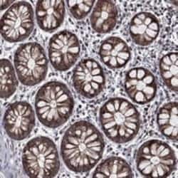 LRDD Antibody, Novus Biologicals:Antibodies:Primary Antibodies