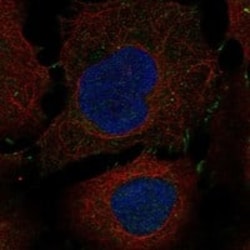 IL-13R alpha 2 Antibody, Novus Biologicals 25 &mu;g; Unconjugated:Antibodies,