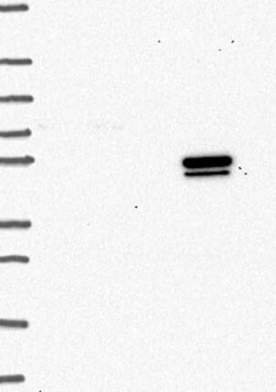 IL-7R alpha/CD127 Antibody, Novus Biologicals:Antibodies:Primary Antibodies