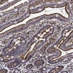 DPPIV/CD26 Antibody, Novus Biologicals:Antibodies:Primary Antibodies