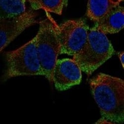 Musashi-2 Antibody, Novus Biologicals 100 &mu;g; Unconjugated:Antibodies,