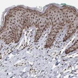 E4F1 Antibody, Novus Biologicals:Antibodies:Primary Antibodies